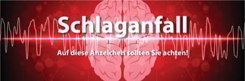 Schlaganfall – Auf diese Anzeichen sollten Sie achten!
