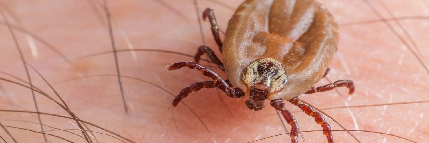 Zeckenstich – Borreliose und FSME erkennen
